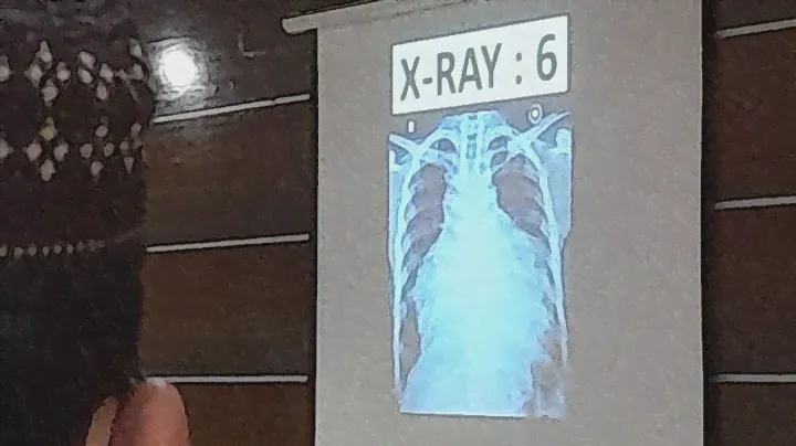 CVS 6